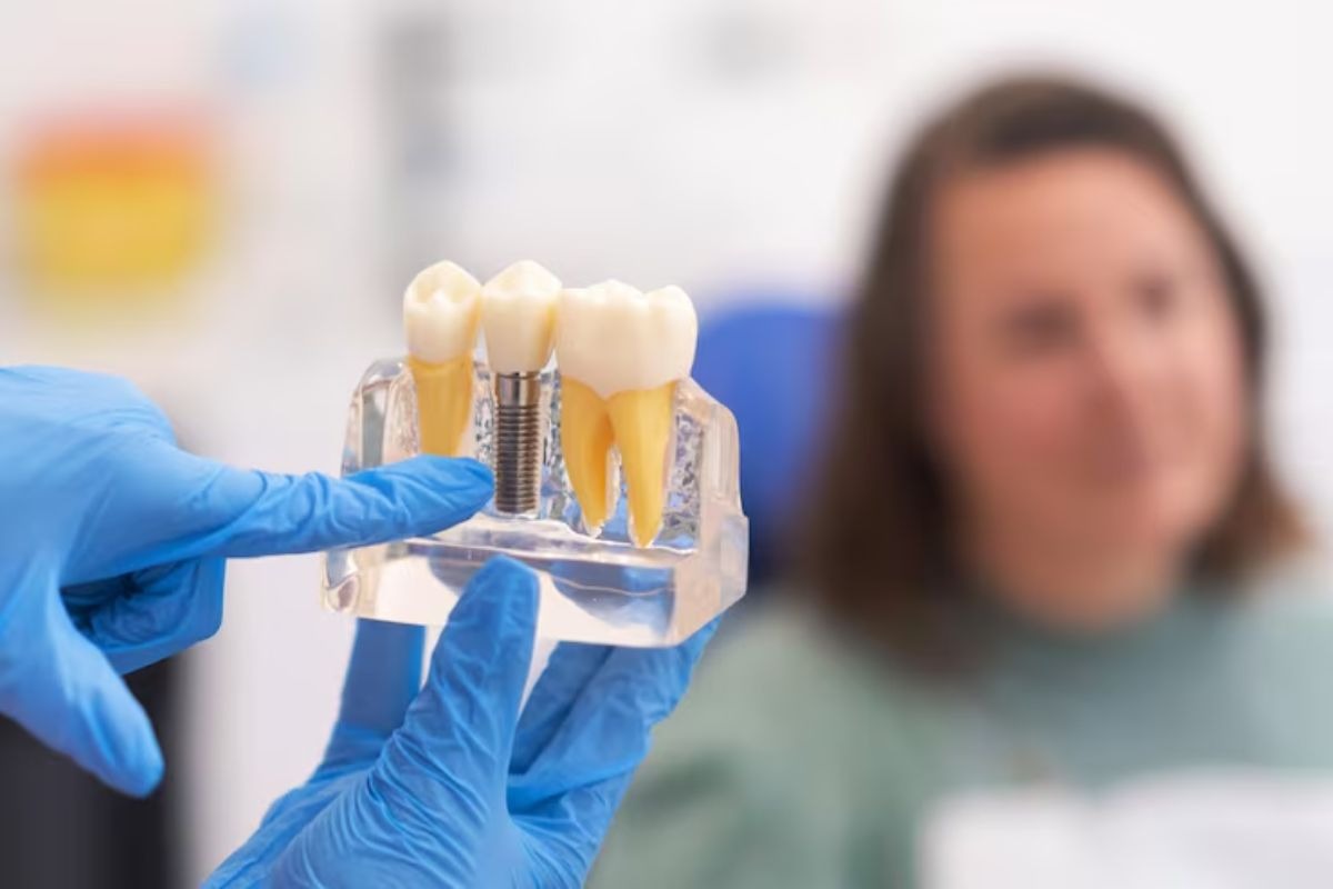 dental implant model used during patient consultation