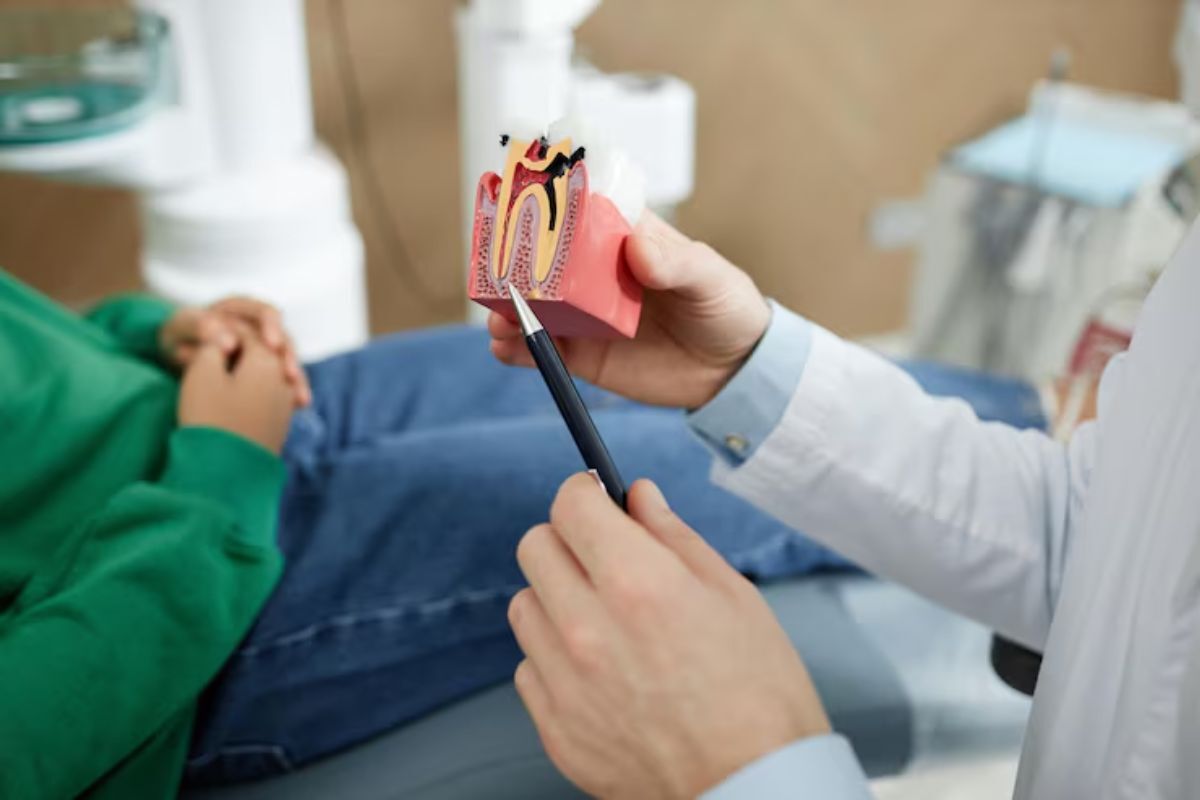 root canal recovery explained with a dental tooth model